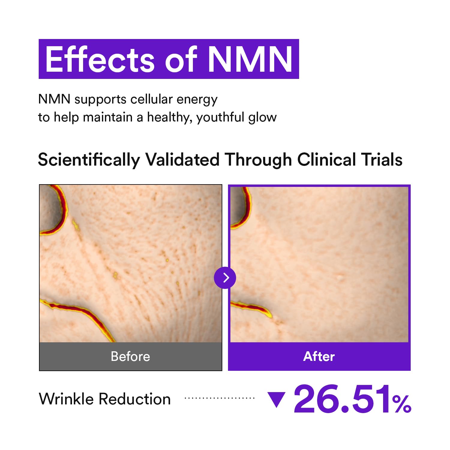 VEGANIFECT NMN Collagen Serum | Elasticity & Firm-Looking Booster with Peptides & Centella Asiatica & Hyaluronic Acid | Skin Resilience & Fine Line Care | Korean Skincare, 1.01 fl.oz