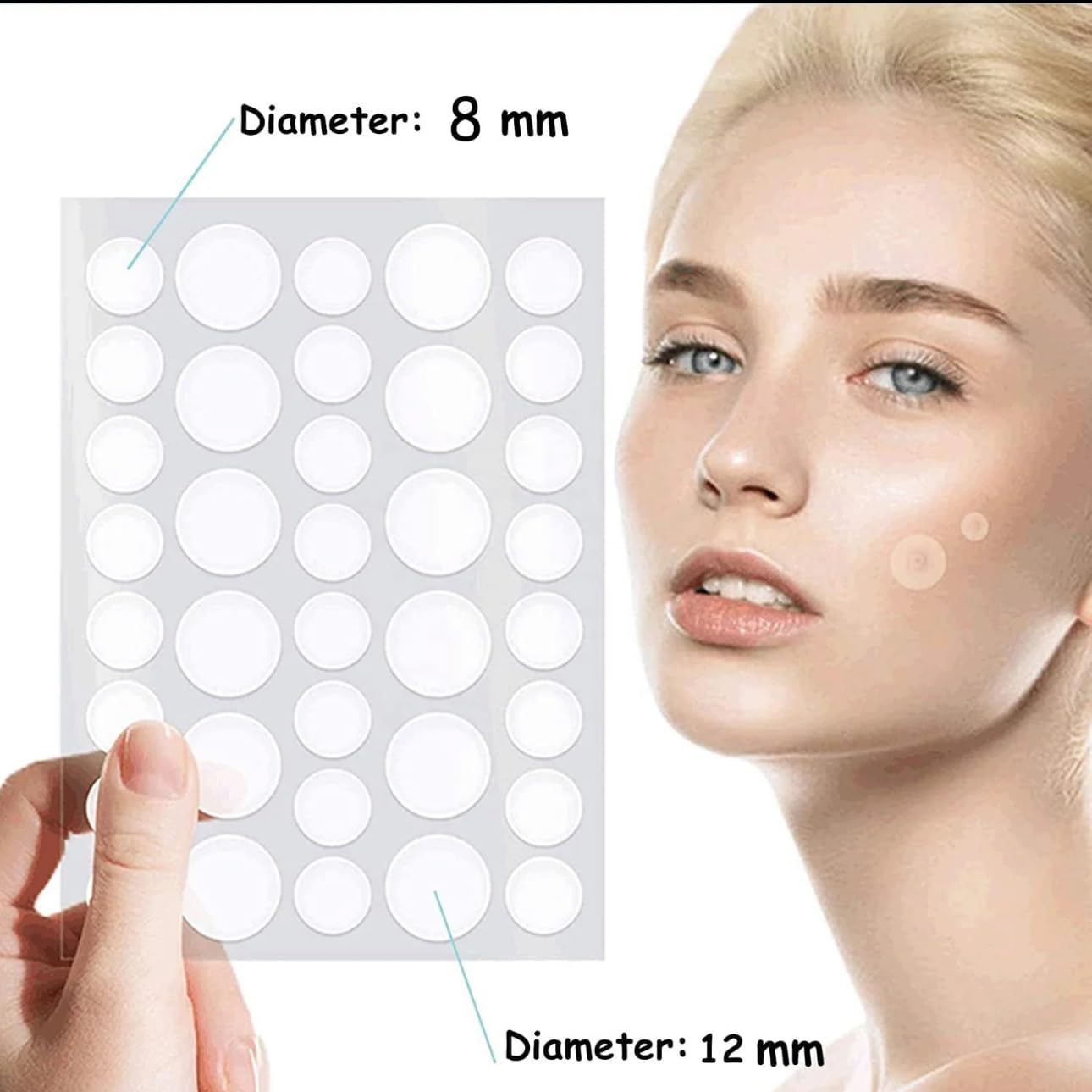 kisskin ZitZap Pimple/Acne Patches For Face And Skin, Hydrocolloid Patches With Salicylic Acid And Tea Tree Oil For Covering Zits And Blemishes.