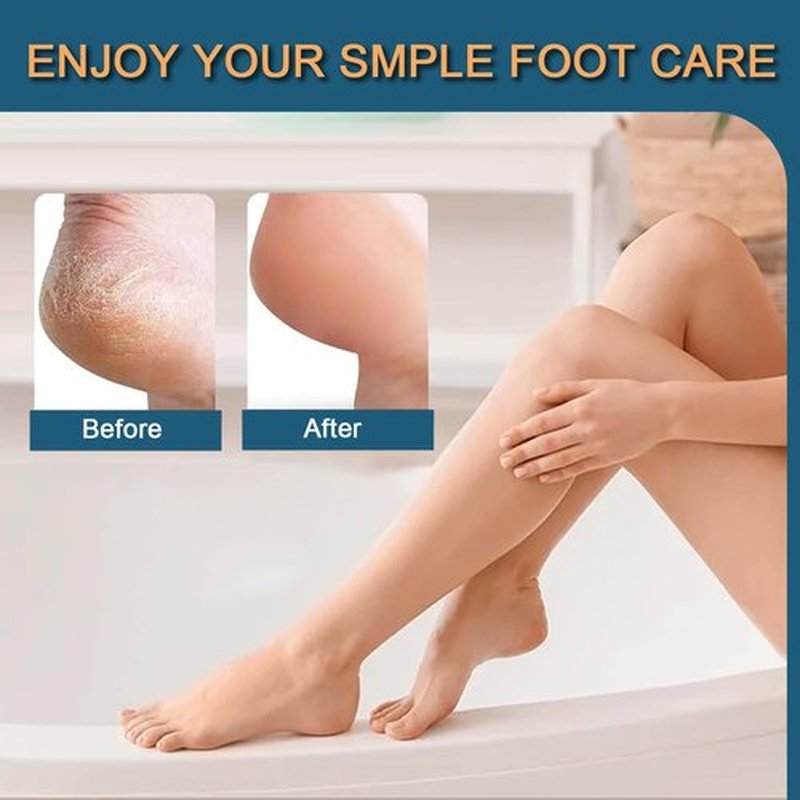 Professional Callus Remover for Feet: 3 Pcs Stainless Steel Foot Scrubber Dead Skin Remover, Foot File Heel Scraper Foot Rasp Foot Grater for Hard Skin, Pedicure Tools for Feet (Golden)