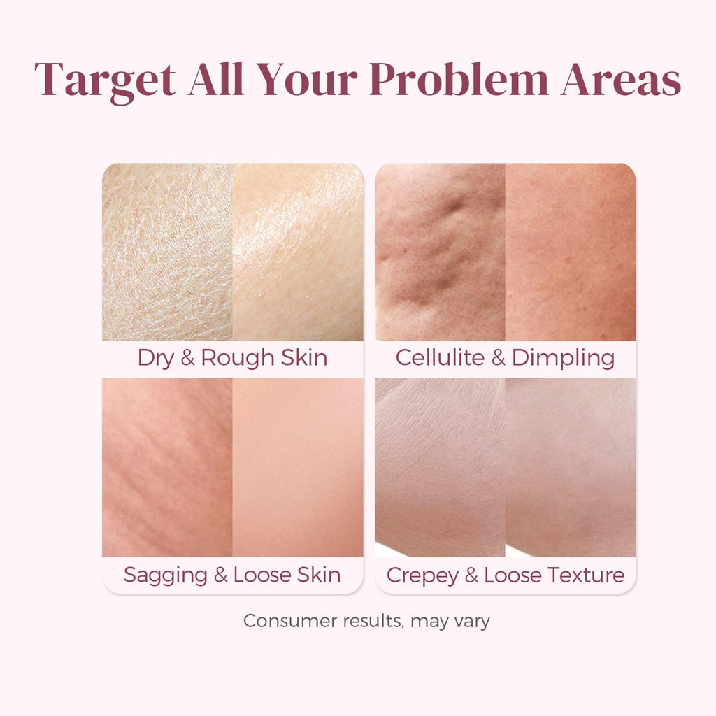 Solivetta Butt Tight Lift and Firm Booty Cellulite Cream - Smooth & Sculpt Booty, Thighs, Belly & Arms | LIFTONIN® Skin Firming & Toning Bum Mask 3.72 fl oz