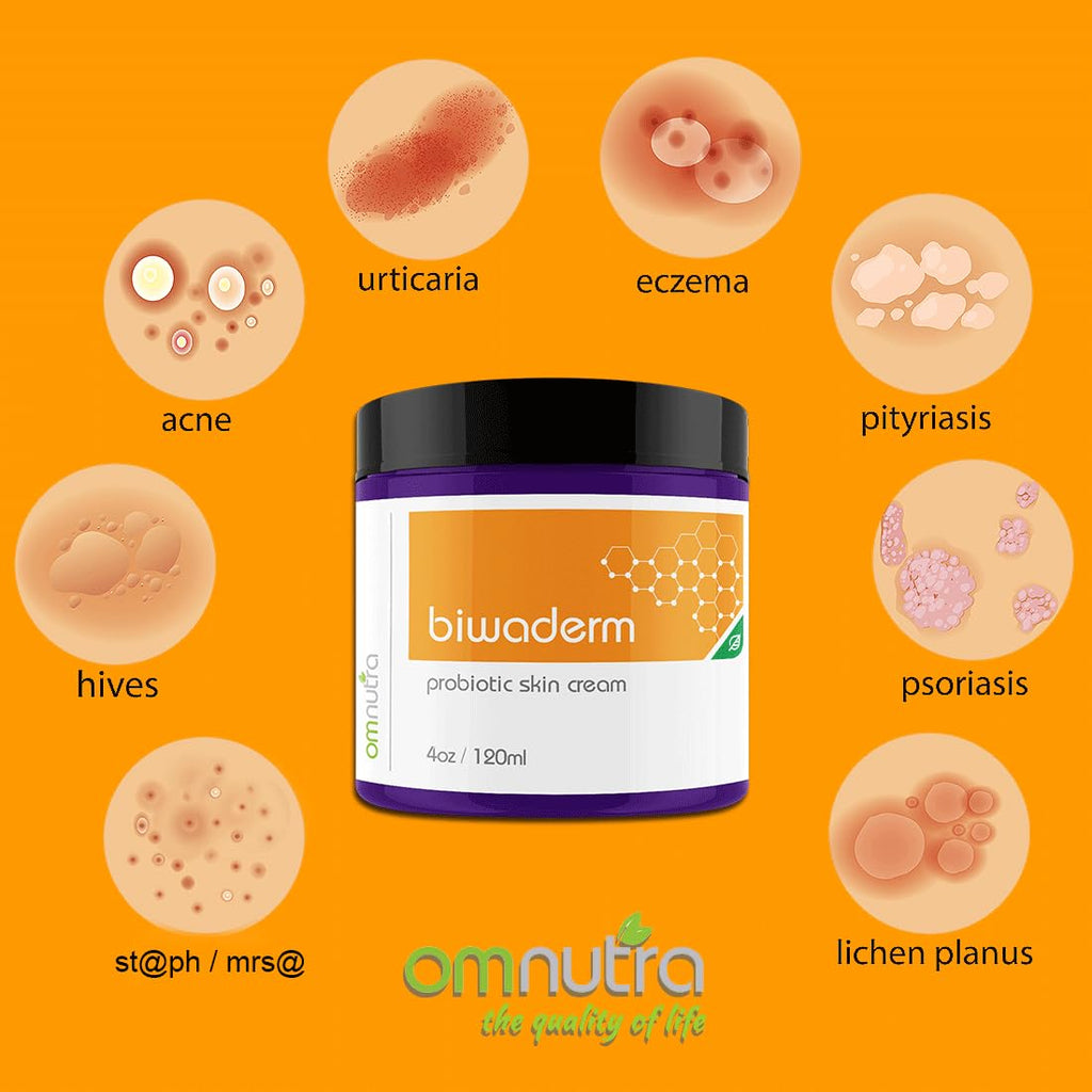 OmNutra Biwaderm Probiotic Skin Cream - 4OZ Organic Based Topical Probiotics for Skin Care Eczema Treatment Psoriasis Treatment for Folliculitis Treatment Pure Aloe Vera Gel 4oz