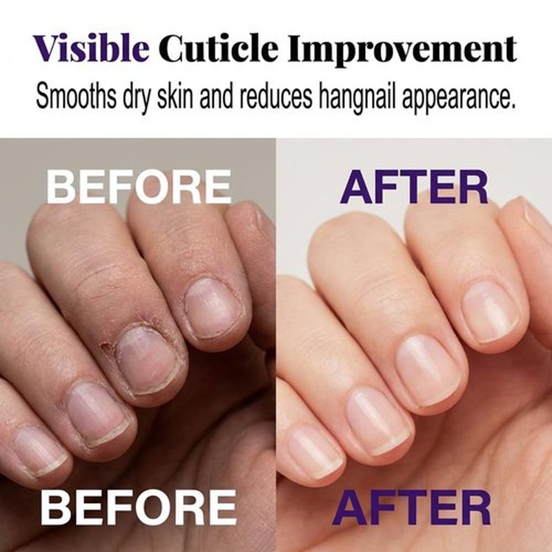 Skiennix Keratin Nail Strengthener - Intensive Nail Repair Oil for Brittle Nails | 1 Piece, 2026 Formula