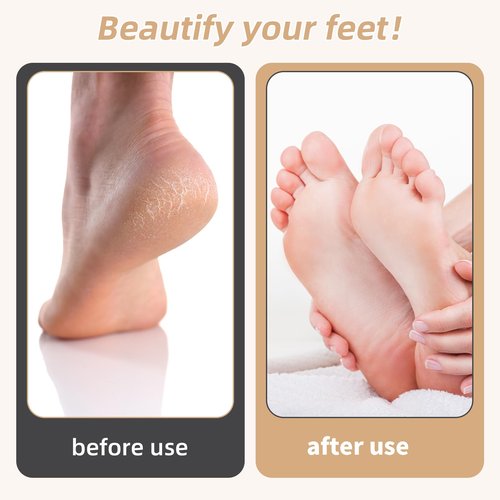 Foot Callus Remover, Foot File Callus Remover for Feet, Double Sided Foot Scrubber with Soft Silicone Brush (Yellow)