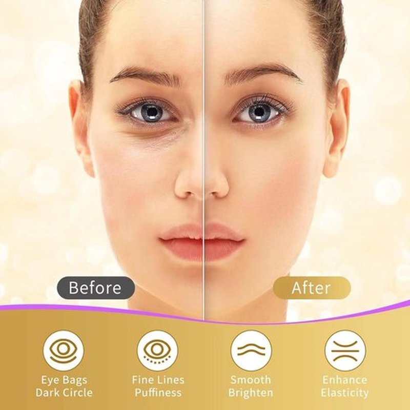 Regine Switzerland Under Eye Patches - 40 Pairs of Gold Infused Eye Masks for Dark Circles & Puffiness