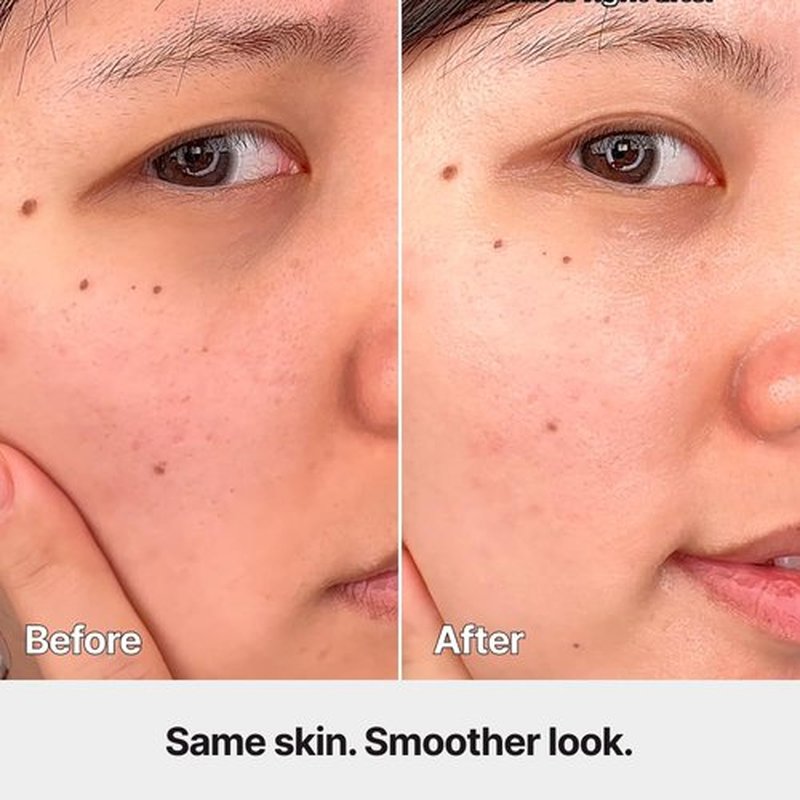 ODELOI Carnosine Lifting Serum - Anti-Aging, Elasticity & Hydration | With Collagen & Adenosine Rich in Wrinkle-Improving Properties |Dermatologist Tested Korean Skincare |All Skin Types |1.76 fl.oz.