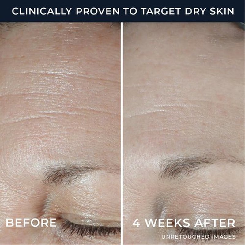 RoC Hydration+ Hyaluronic Acid Moisturizer Face Cream Fragrance Free Sensitive Face Moisturizer with Collagen Proteins 1.7 Ounces with Retinol Eye Cream Packette