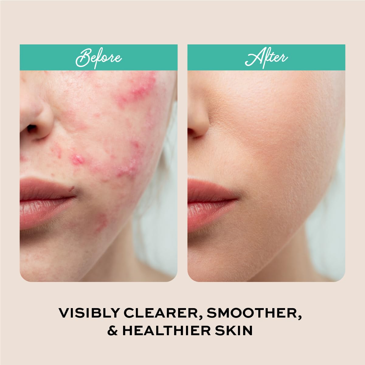 The Natural and Organic Family Clarifying Face Wash with Salicylic Acid - Facial Cleanser for Oily, Normal, and Combination Skin - Exfoliating, Pore Minimizing Formula for Teens