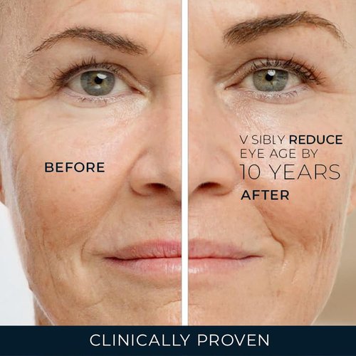 RoC Retinol Correxion Under Eye Cream - Reduce Dark Circles & Puffiness | Anti-Aging Treatment, 0.5 oz