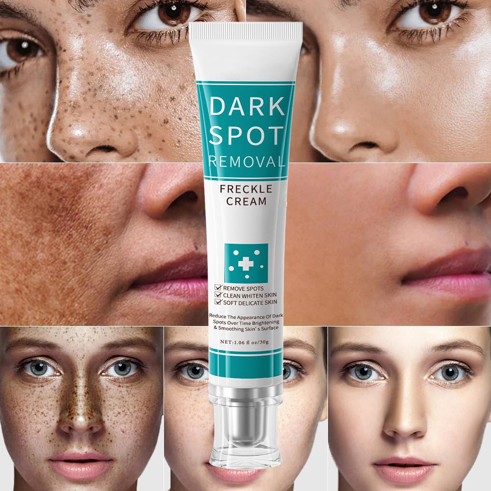 paminify Dark Spot Remover For Face & Body, Nicotinamide Freckle Remover Cream,Anti-Aging Dark Spot Corrector for Age Spot,Sun Spot,Moisturizing & Gentle on Skin,1 oz