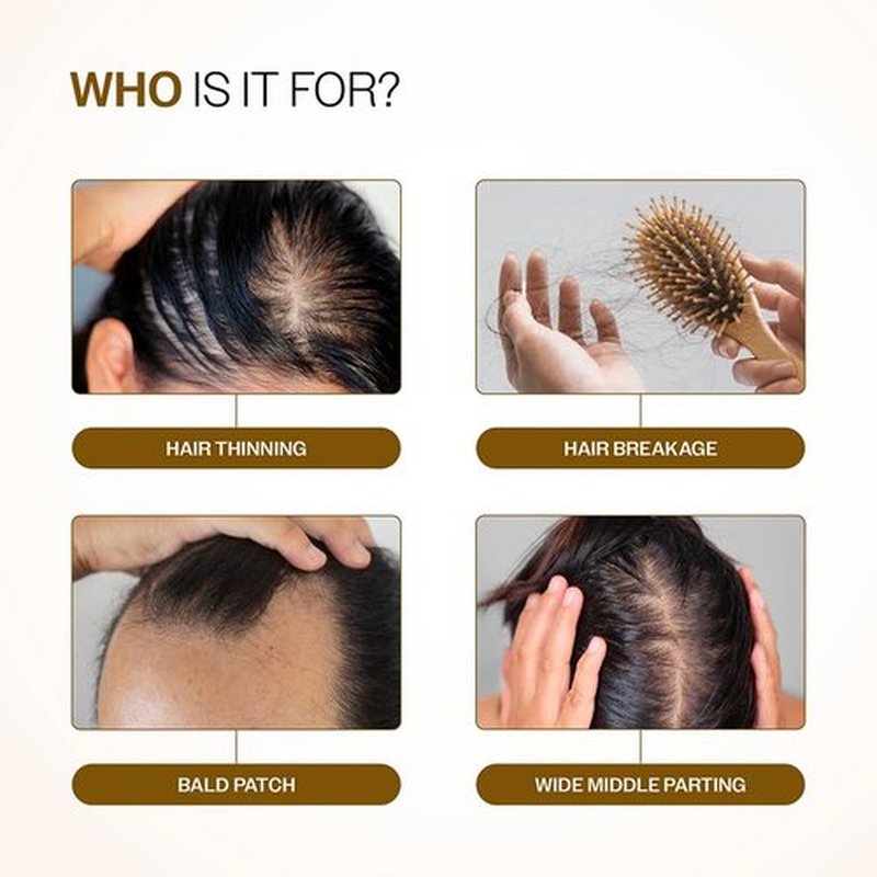 Bare Anatomy Advanced Hair Density Serum boosts density with Redensyl, Anagain, Baicapil & Capilia Longa. Rosemary & rice water reduce hair fall for men & women.