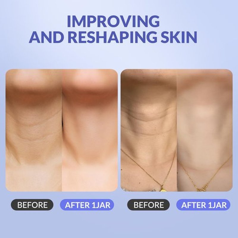Crogooe Neck Firming Cream - Neck Creams for Tightening and Firming, Tightening and Lifting Wrinkles & Crepey Skin for Neck & Décolleté-1.7 fl.oz