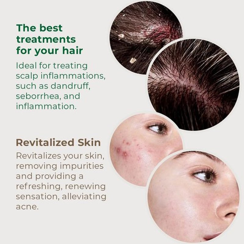 Skiennix Detox Hydrating Gel Hair Mask - Nourishing Oil Control for Hair & Scalp - Vegan, Green Clay & Red Seaweed - 7.05oz
