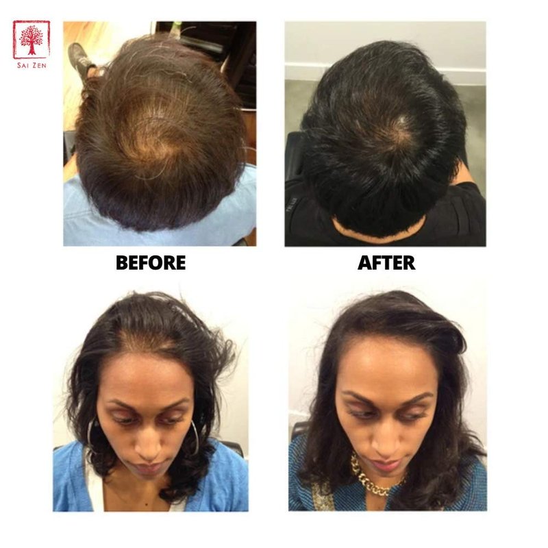 Volume Plus Shampoo - Anti-Thinning & Volumizing Formula | Sulfate & Paraben Free | 8 oz for All Hair Types