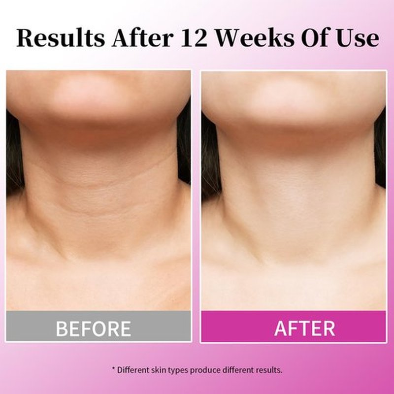 MRLILEI Tightening & Lifting Neck Cream, 4 in 1 Neck Moisturizer Cream, Advanced Anti-Aging Face Moisturizer, Reduces Fine Lines & Wrinkles for Neck & Face & Chest - 1.7 fl.oz.