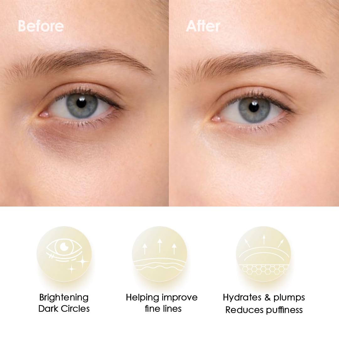 Sweet Dreams Collagen Glow Gold Eye Masks l Korean Under Eye Patches Puffy Eyes, Dark Circles & Wrinkles | Collagen, Niacinamide, Hyaluronic Acid & Peptides | Hydrating Eye Treatment& Self Beauty Care