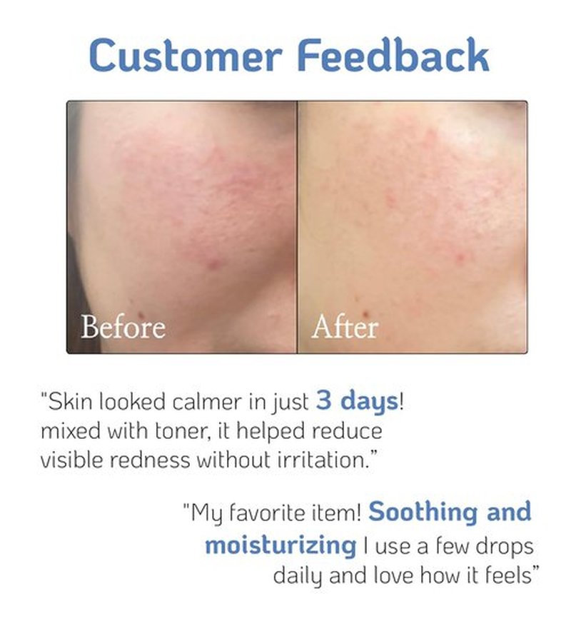 High-Potency Pure D-Panthenol for Intensive Hydration, Calming, and Skin Barrier Recovery with Only a Drop in Your Skincare and Haircare Routine 33g 1Fl Oz