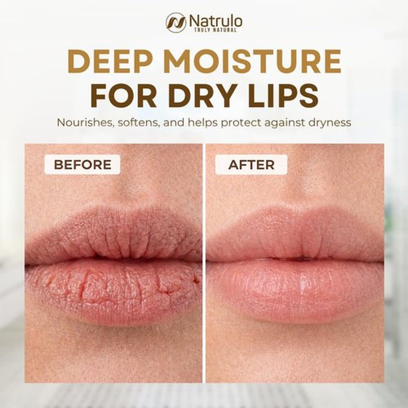 Coconut Lip Balm - Hydrating Natural Chapstick with Coconut Oil & Beeswax for Dry Lips | Made in USA