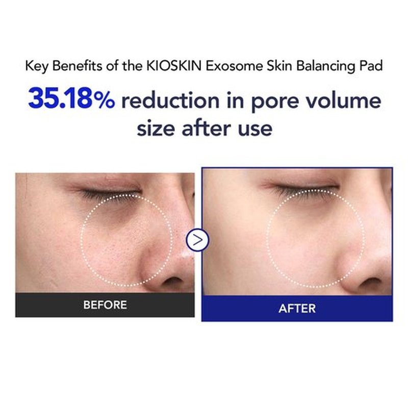35% Smaller Pores & 32% Reduced Pore Area | Brightening Exfoliating Pads | Soothes, Hydrates & Brightens with CICA Exosomes, AHA/BHA/PHA & Fruit Enzymes | Korean Skincare | 70 Pads