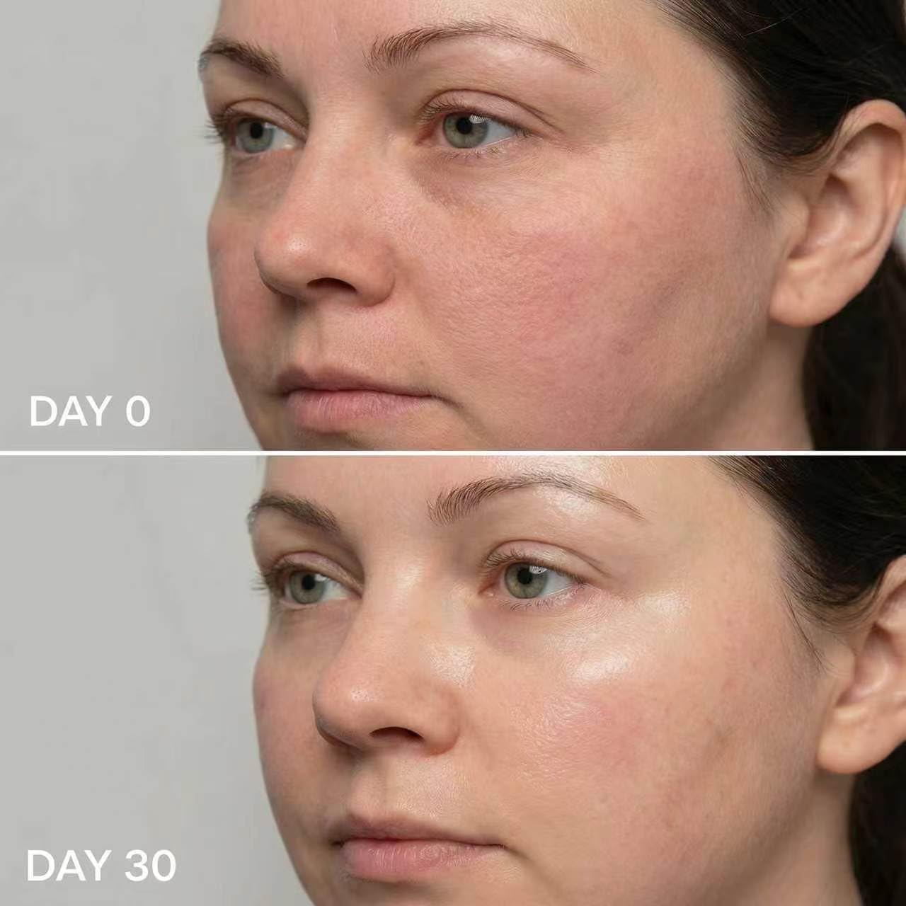 Micro Infusion System for Face & Neck-Micro Infusion Kit to Leave Skin Firmer & Smoother-0.25mm Facial Stamp with Collagen & Hyaluronic Acid Serum for At Home Glow and Anti-aging-1 Month Supply