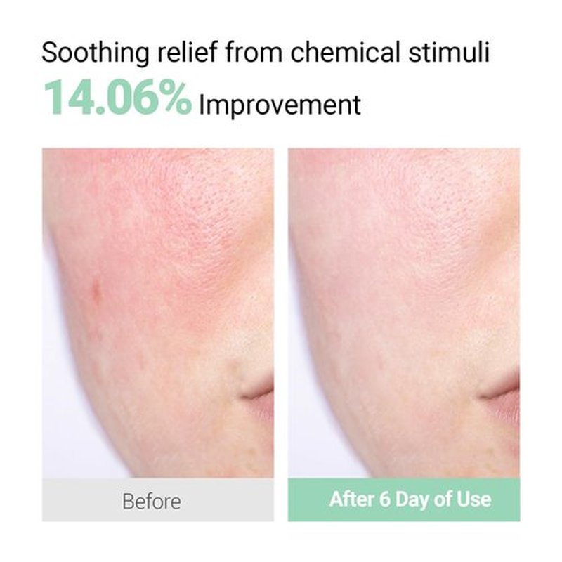NEAF NEAF Soothing Calm Cream with Panthenol, Hyaluronic Acid for Sensitive Skin, Lightweight, Korean Skincare (50ml/ 1.76 oz.) Nourishing Skin Barrier Moisturizer