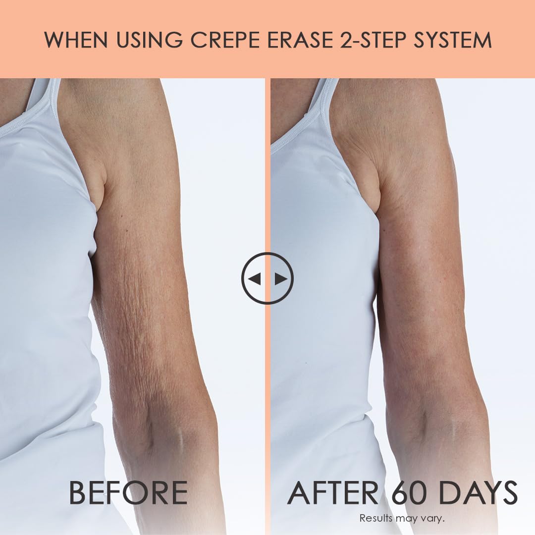 BODY FIRM Crepe Erase-2-Step Advanced Body Treatment System Kit, Original Citrus Scent,2 Piece(Pack of 1) ( Packaging May Vary )