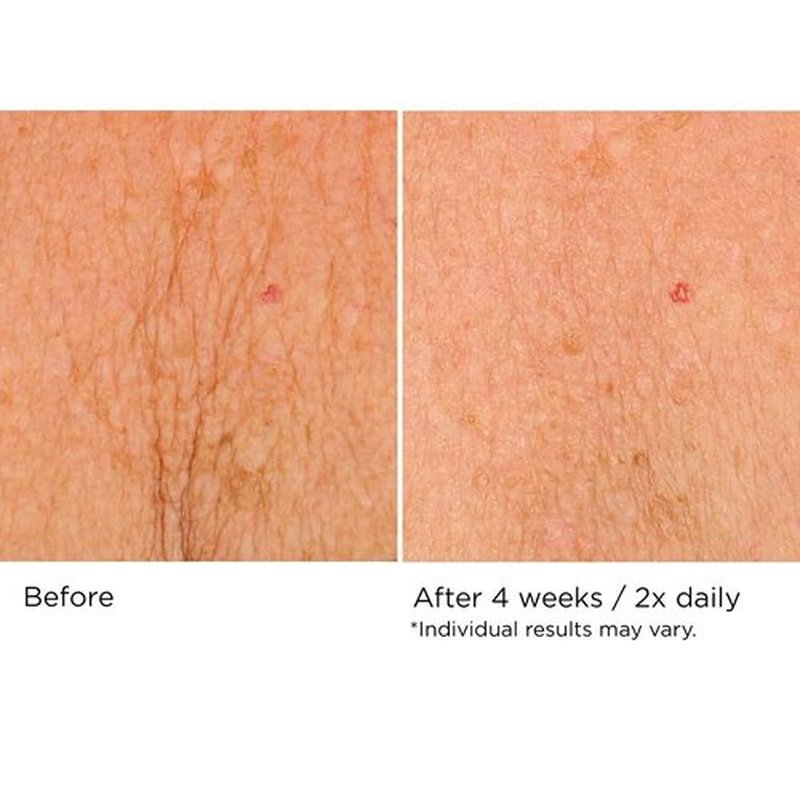 NassifMD Neck & Decollete Firming Complex - Lifting Treatment for Youthful Skin