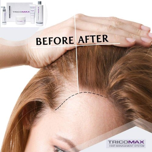 Hair Growth Vitamins for Women & Men - Biotin, Keratin & Saw Palmetto Hair Supplements - Stop Hair Loss & Thinning - Best Hair Pills for Faster Growth, Stronger Nails & Skin Health 120 Tablets