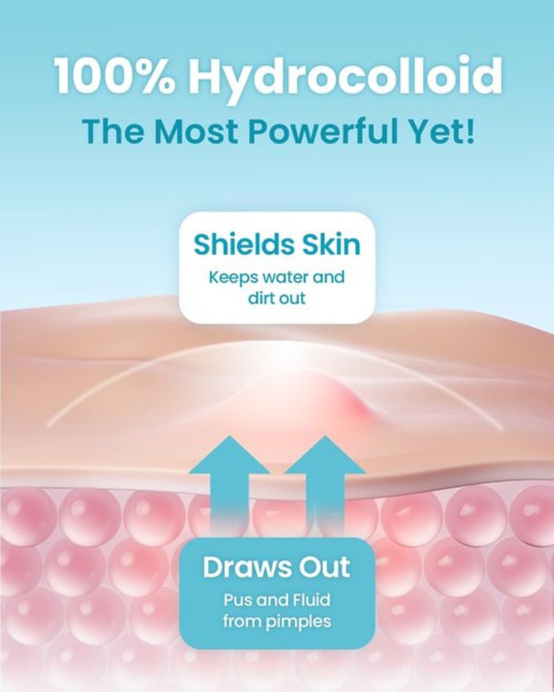 GLAM UP Hydrocolloid Pimple Patches - Invisible Ultra Thin Spot Covers for Face, Waterproof & Vegan (36 Count)