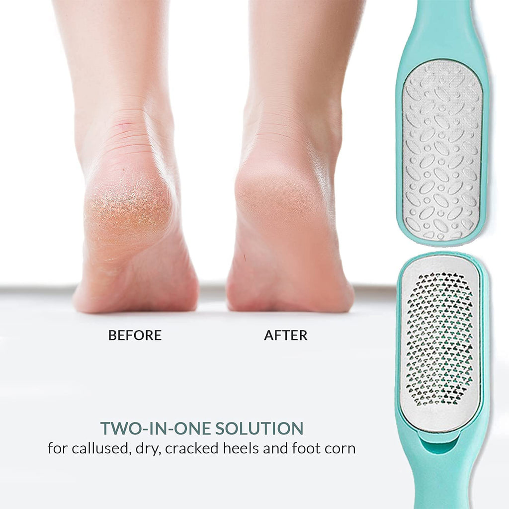 Relax Tony Callus & Dead Skin Remover – Dual-Sided - for Wet & Dry Exfoliation: Scrub, File & Rasp for Smooth Feet - Pedicure Tool - Foot File Callus Remover Tool - Pedicure Kit