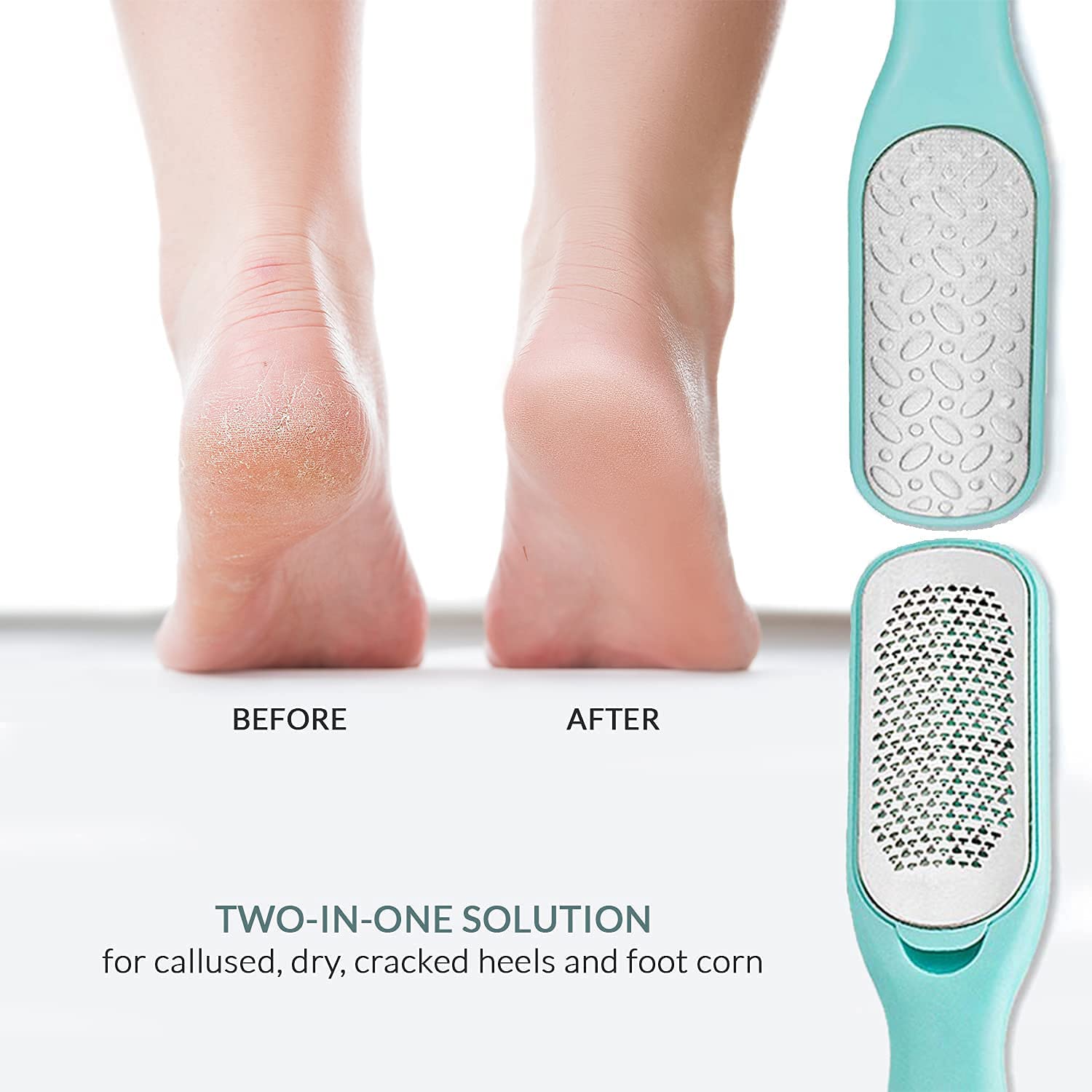 Relax Tony Callus & Dead Skin Remover – Dual-Sided - for Wet & Dry Exfoliation: Scrub, File & Rasp for Smooth Feet - Pedicure Tool - Foot File Callus Remover Tool - Pedicure Kit