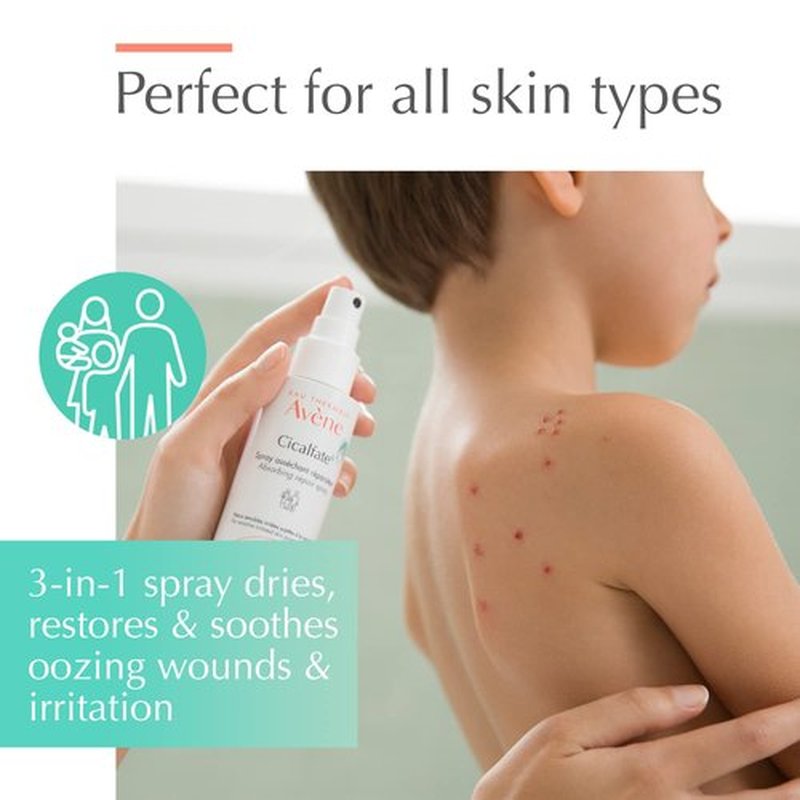Avène Cicalfate+ Soothing Spray - Restores Irritated Skin Barrier | Safe for All Ages