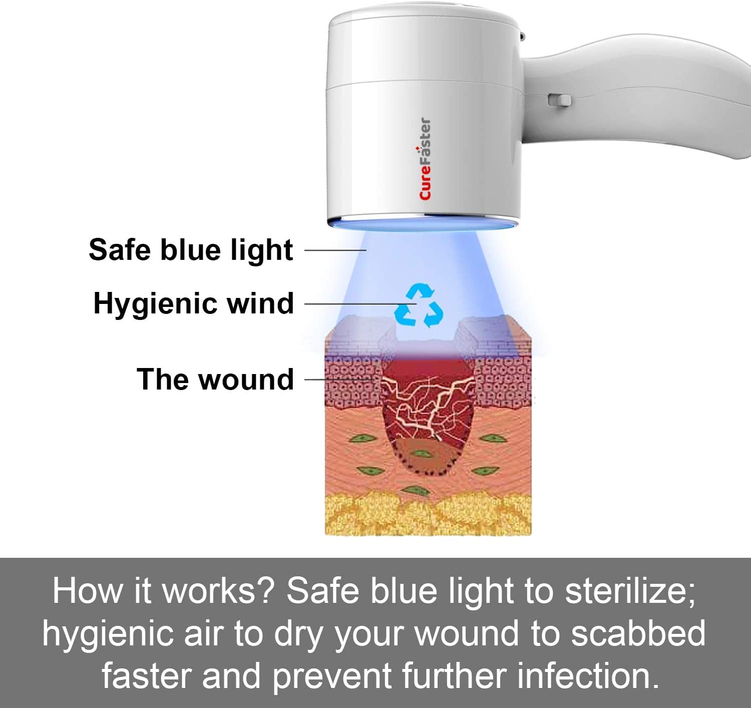 Curefaster Wound Care Patient Care to Help Acute and Chronic Wound Seal Closure for Elders,Diabetes, Bedsore,Pressure Sore Healing and Skin Immune Ulcer Disease