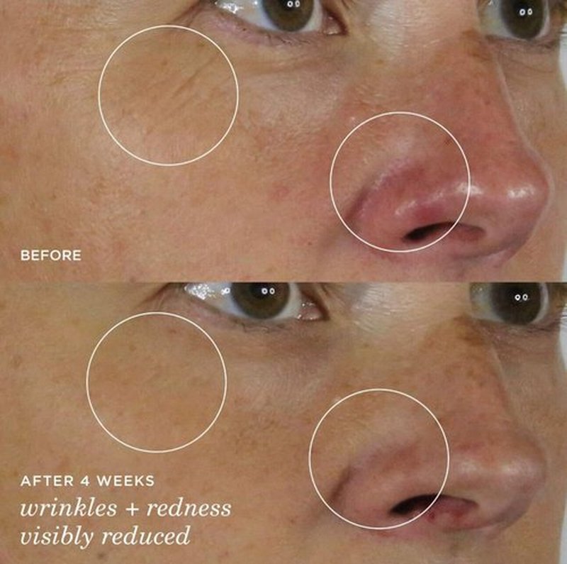 Tatcha The Silk Serum Wrinkle-Smoothing Retinol Alternative | 30 ml / 1 oz