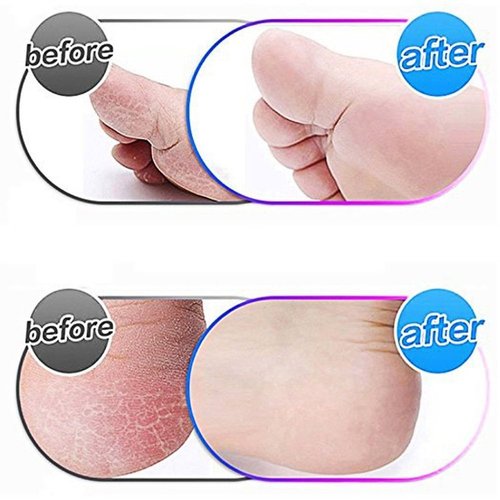 8 Pack Black Replacement Roller Refills Compatible with Scholl Express Pedi Foot Smoother-Extra Coarse