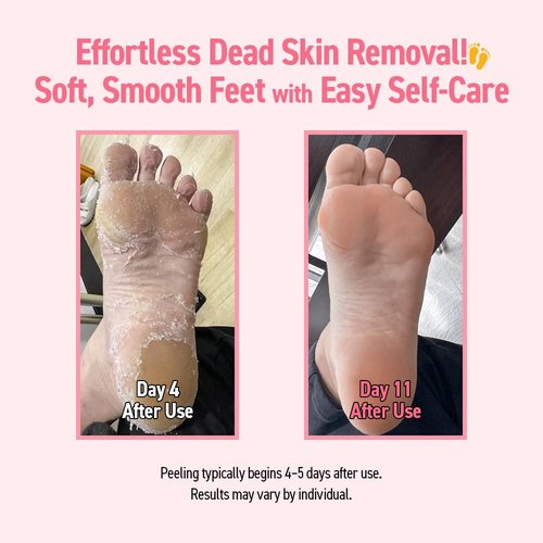 MADFORCOS Exfoliating Foot Peel Mask with AHA/BHA & 4 Fruit Extracts – Removes Dead Skin & Calluses for Baby Soft Feet – Foot Peeling Mask Socks for Dry, Cracked Feet (4 Pairs)