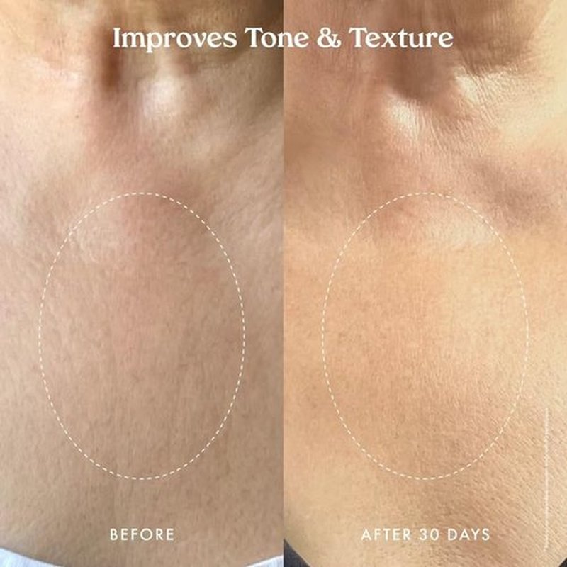 Kopari Ultra Restore Firming Body Serum with Dual Peptide Complex, Deeply Hydrates, Improves Skin Tone & Texture, Firms & Enhances Elasticity, 5 oz