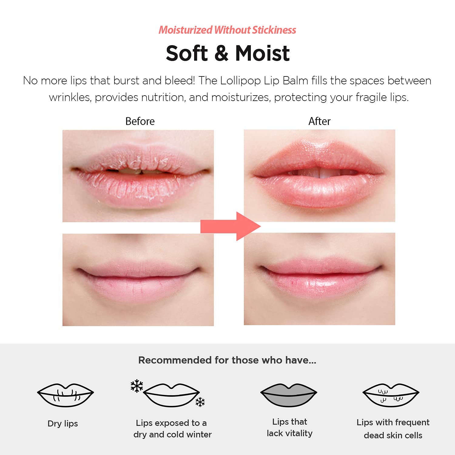FASCY Lollipop Lip Balm – Lip Balms & Moisturizers, Premium Korean Beeswax + Moisturizing Shea Butter, Natural Soybean, and Vitamin E – Paraben-Free – Small (0.13 oz) (Strawberry)