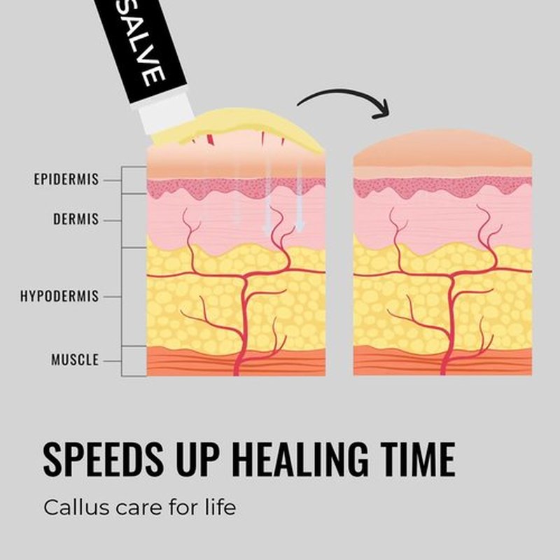 SandBar Natural Callus Salve - Revitalizing Callus Balm - Heal, Nourish & Maintain Your Calluses - On The Go Callus Repair & Care - Convenient Essential - Immediate Relief For Callus Tears 0.15 o z