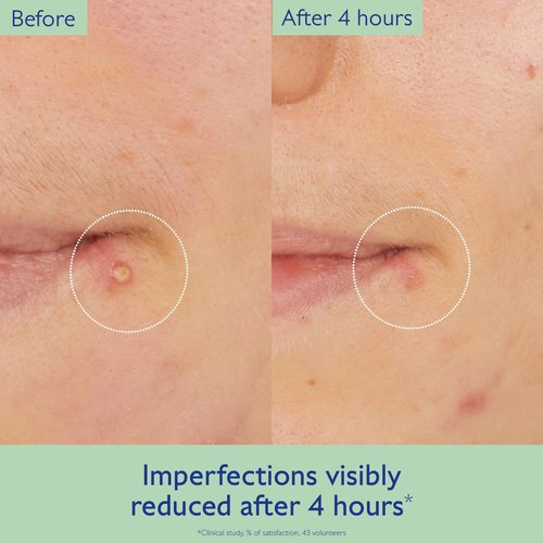 Caudalie Vinopure Targeted Spot Solution with Salicylic Acid - 15 mL