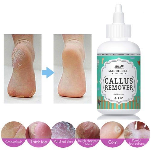 Maccibelle Callus Remover EXTRA STRENGTH For Feet, Professional Callus and Corn Eliminator Liquid Gel 4 oz (1 Bottle)