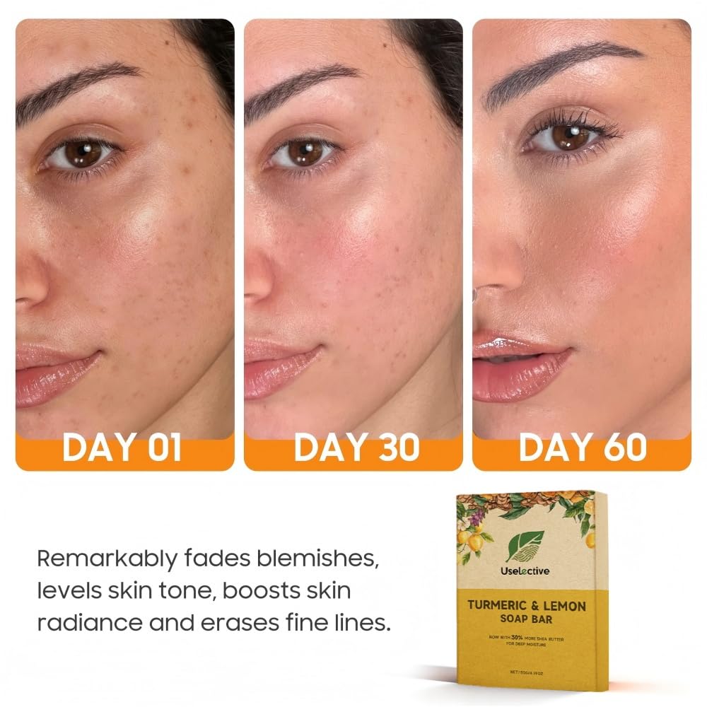 Uselective Lemon & Turmeric Glow Soap Bar for Dark Spots Remover, Powered by Kojic Acid & Vitamin C for Brightening & Fading Acne Scars - 3x Moisturizing with Shea Butter - SLS Free