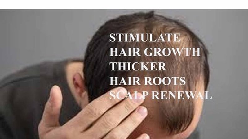 Super Growth DHT Blocker Cream - Promote Healthy Hair Growth | 4 oz