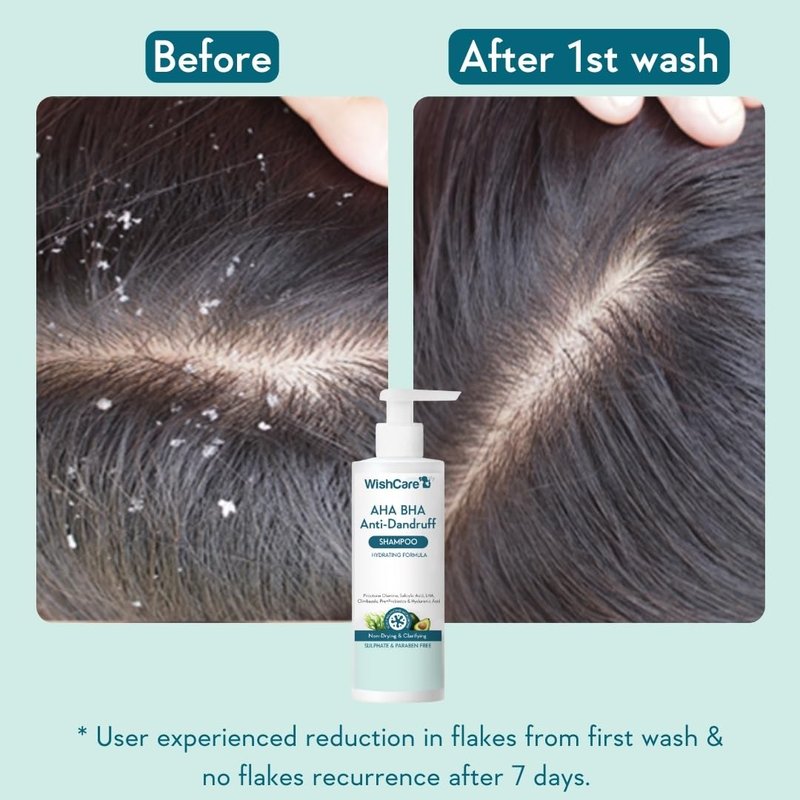 WishCare Hydrating AHA BHA Anti Dandruff Shampoo For Women & Men-Paraben & Sulphate Free Shampoo 250ml