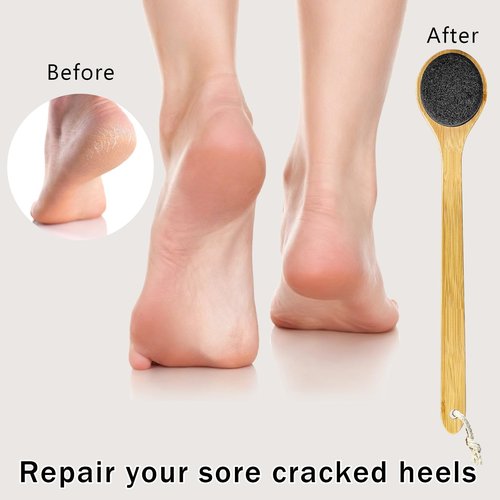 Beomeen Pumice Stone for Feet with Long Handle 15.7", Hard Skin Callus Remover, Scrubber and Exfoliator for Dead Dry Skin, Softer & Smoother Feet, Pedicure Tool Grey