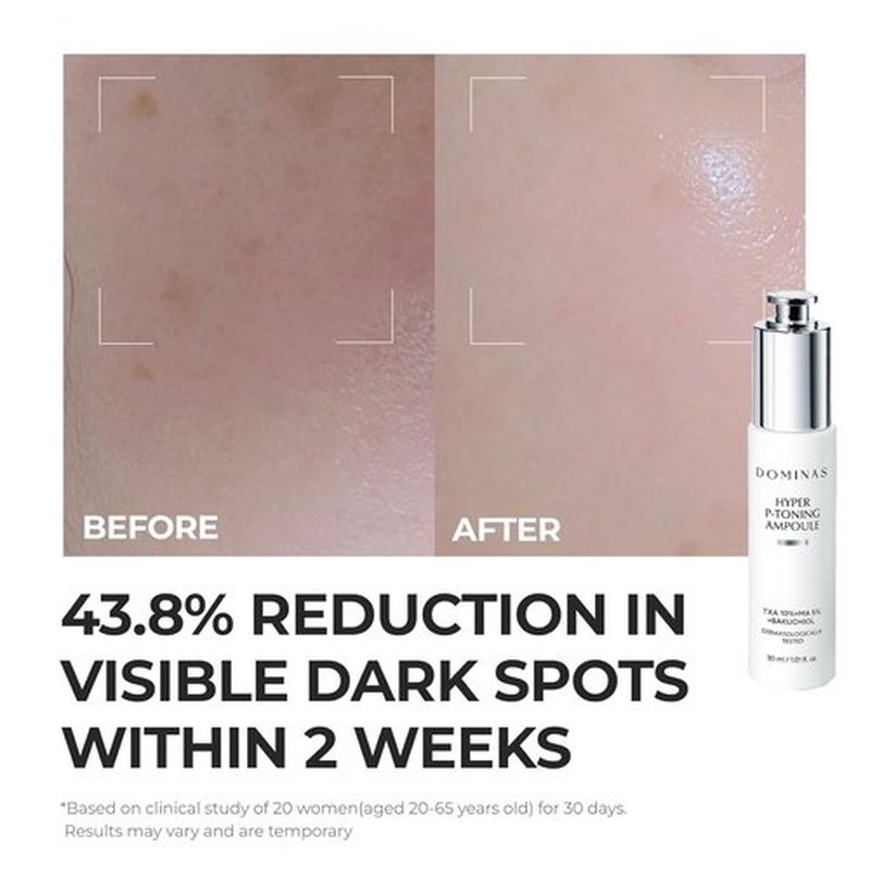 DOMINAS 10% TXA Hyper P-Toning Serum - Brightening & Discoloration Correcting with 5% AHA, 5% Niacinamide | 1.01 fl oz