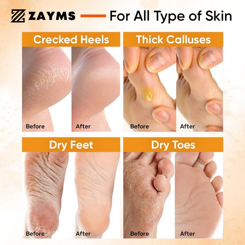 ZAYMS Foot Peeling Mask 5 Pack - Exfoliating Mask for Baby Soft Feet, Removes Dead Skin & Calluses, Repairs Cracked Heels, Natural Peel for Smooth, Soft Feet