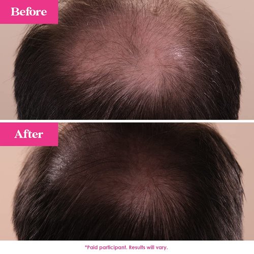 Grande Cosmetics GrandeHAIR Hair Enhancing Serum - Promotes Thickness for Men & Women | Safe for Color-Treated Hair