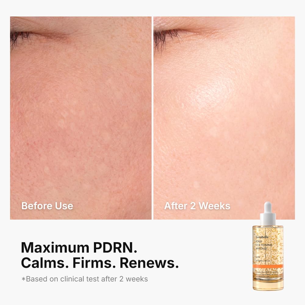 Genabelle PDRN Vitamin c Serum Toning Ampoule JUMBO SIZE - Lightweight Glass Skin,korean skin care with Vitamin B, C, E, PDRN, Serum for Blemishes, Fine Lines and Rough Skin Texture, 2.36 fl oz