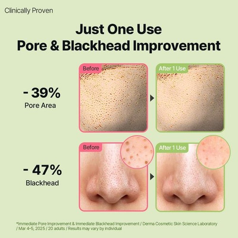 DearMYDEW HYCICA Soothing Pore Cleansing Oil | Non-Comedogenic Makeup Blackhead Remover for Sensitive Skin with 7 CICA & 10 HA, Deep Pore Cleanser, Double Cleansing, Korean Skincare, 6.76 fl oz