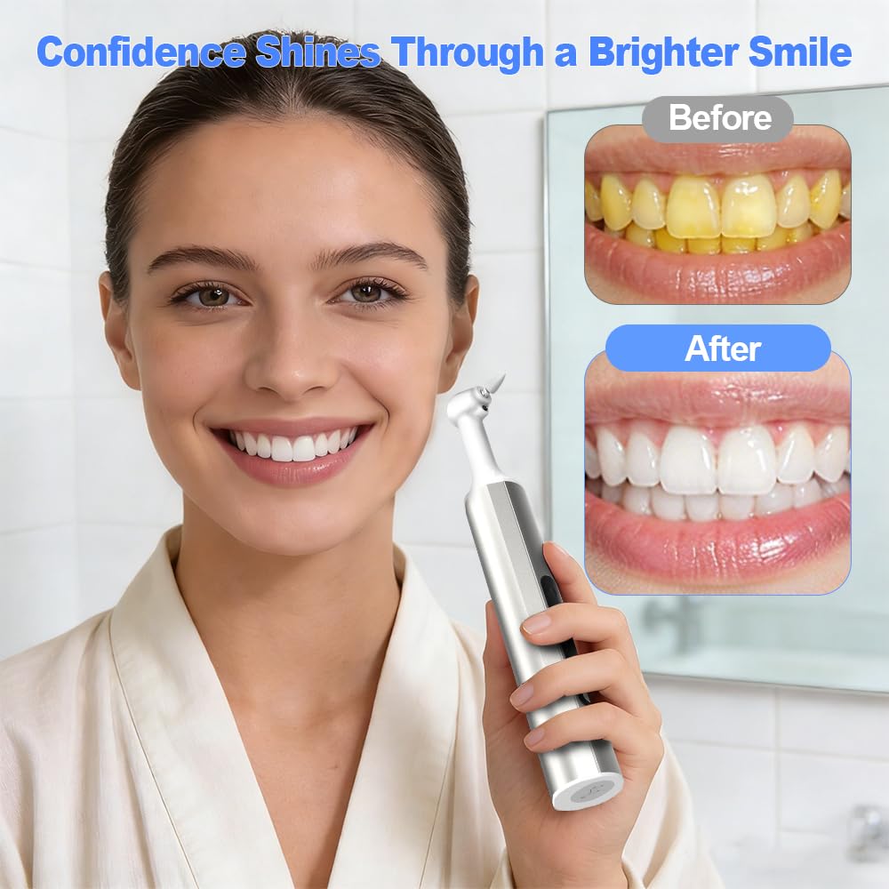 Home Tooth Polisher,Multi-Functional LED Tooth Polisher,Aluminum Alloy with Anti-Slip Texture,9 polishing Paste Units,USB Type-C Charging,6 Polished Accessories,Personal Portable Dental Care Tool